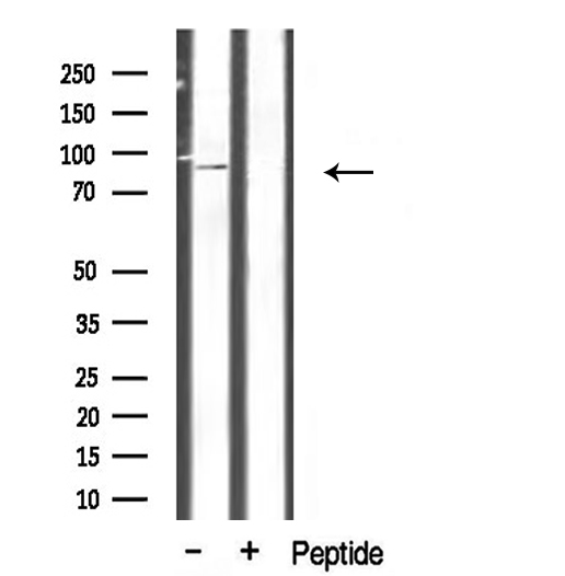 CHSY1 Antibody - Western blot analysis of extracts of mouse brain tissue using CHSY1 antibody.