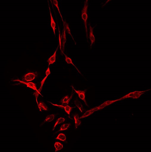 CHSY1 Antibody - Staining HepG2 cells by IF/ICC. The samples were fixed with PFA and permeabilized in 0.1% Triton X-100, then blocked in 10% serum for 45 min at 25°C. The primary antibody was diluted at 1:200 and incubated with the sample for 1 hour at 37°C. An Alexa Fluor 594 conjugated goat anti-rabbit IgG (H+L) Ab, diluted at 1/600, was used as the secondary antibody.