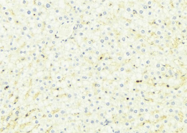 CHSY1 Antibody - 1:100 staining mouse liver tissue by IHC-P. The sample was formaldehyde fixed and a heat mediated antigen retrieval step in citrate buffer was performed. The sample was then blocked and incubated with the antibody for 1.5 hours at 22°C. An HRP conjugated goat anti-rabbit antibody was used as the secondary.