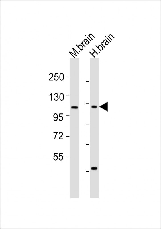 CHSY3 / CSS3 Antibody - All lanes : Anti-CHSY3 Antibody at 1:1000-1:2000 dilution Lane 1: mouse brain lysates Lane 2: human brain lysates Lysates/proteins at 20 ug per lane. Secondary Goat Anti-Rabbit IgG, (H+L), Peroxidase conjugated at 1/10000 dilution Predicted band size : 100 kDa Blocking/Dilution buffer: 5% NFDM/TBST.