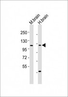 CHSY3 / CSS3 Antibody - All lanes : Anti-CHSY3 Antibody at 1:1000-1:2000 dilution Lane 1: mouse brain lysates Lane 2: human brain lysates Lysates/proteins at 20 ug per lane. Secondary Goat Anti-Rabbit IgG, (H+L), Peroxidase conjugated at 1/10000 dilution Predicted band size : 100 kDa Blocking/Dilution buffer: 5% NFDM/TBST.
