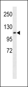 CHSY3 / CSS3 Antibody - CHSY3 Antibody western blot of A549 cell line lysates (35 ug/lane). The CHSY3 antibody detected the CHSY3 protein (arrow).