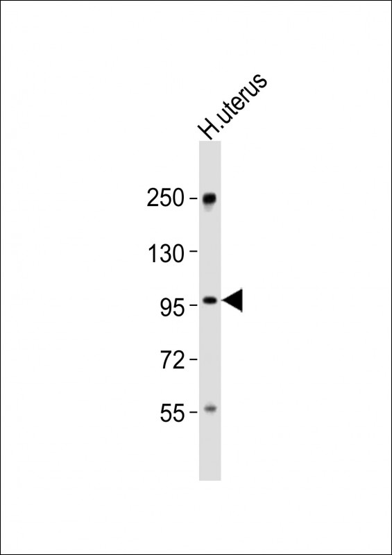 CHSY3 / CSS3 Antibody - Anti-CHSY3 Antibody at 1:1000 dilution + human uterus lysates Lysates/proteins at 20 ug per lane. Secondary Goat Anti-Rabbit IgG, (H+L), Peroxidase conjugated at 1/10000 dilution Predicted band size : 100 kDa Blocking/Dilution buffer: 5% NFDM/TBST.