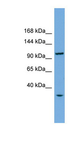 CHTF18 / RUVBL Antibody - CHTF18 antibody Western blot of Fetal liver lysate. This image was taken for the unconjugated form of this product. Other forms have not been tested.