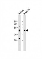 CHTF8 / C10orf18 Antibody - All lanes: Anti-CHTF8 Antibody (N-Term) at 1:2000 dilution. Lane 1: human liver lysate. Lane 2: human testis lysate Lysates/proteins at 20 ug per lane. Secondary Goat Anti-Rabbit IgG, (H+L), Peroxidase conjugated at 1:10000 dilution. Predicted band size: 51 kDa. Blocking/Dilution buffer: 5% NFDM/TBST.