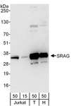 CHTOP / FOP Antibody - Detection of Human SRAG by Western Blot. Samples: Whole cell lysate from Jurkat (15 and 50 ug), 293T (T; 50 ug) and HeLa (H; 50 ug) cells. Antibody: Affinity purified rabbit anti-SRAG antibody used for WB at 0.4 ug/ml. Detection: Chemiluminescence with an exposure time of 30 seconds.