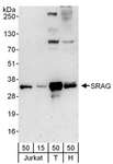 CHTOP / FOP Antibody - Detection of Human SRAG by Western Blot. Samples: Whole cell lysate from Jurkat (15 and 50 ug), 293T (T; 50 ug) and HeLa (H; 50 ug) cells. Antibody: Affinity purified rabbit anti-SRAG antibody used for WB at 0.1 ug/ml. Detection: Chemiluminescence with an exposure time of 3 minutes.