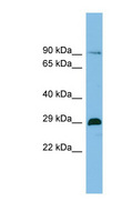 CHTOP / FOP Antibody - CHTOP / C1orf77 antibody Western blot of THP-1 cell lysate. This image was taken for the unconjugated form of this product. Other forms have not been tested.