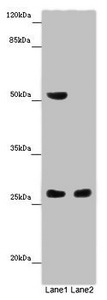 CHTOP / FOP Antibody - Western blot All Lanes: CHTOP antibody at 14 ug/ml Lane 1: Mouse heart tissue Lane 2: Mouse kidney tissue Secondary Goat polyclonal to rabbit IgG at 1/10000 dilution Predicted band size: 27,22 kDa Observed band size: 26,52 kDa