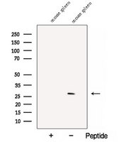 CHTOP / FOP Antibody - Western blot analysis of extracts of mouse spleen tissue using C1orf77 antibody. The lane on the left was treated with blocking peptide.