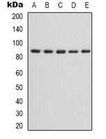 CHUK/IKBKB Antibody - Western blot analysis of IKK alpha/beta expression in HepG2 (A); HEK293T (B); NIH3T3 (C); mouse brain (D); rat heart (E) whole cell lysates.