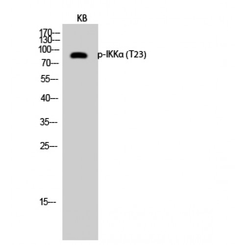 CHUK / IKKA / IKK Alpha Antibody - Western blot of Phospho-IKKalpha (T23) antibody