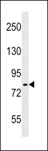 CHUK / IKKA / IKK Alpha Antibody - IKK(alpha/beta) Antibody (S176/180) western blot of A549 cell line lysates (35 ug/lane). The IKK antibody detected the IKK protein (arrow).