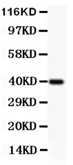 CHUK / IKKA / IKK Alpha Antibody - IKK alpha antibody Western blot. All lanes: Anti IKKA at 0.5 ug/ml. WB: Recombinant Human IKKA Protein 0.5ng. Predicted band size: 40 kD. Observed band size: 40 kD.