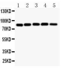 CHUK / IKKA / IKK Alpha Antibody - Anti-IKK alpha Picoband antibody, All lanes: Anti IKKA at 0.5ug/ml Lane 1: MCF-7 Whole Cell Lysate at 40ugLane 2: SGC Whole Cell Lysate at 40ugLane 3: PANC Whole Cell Lysate at 40ugLane 4: HELA Whole Cell Lysate at 40ug Lane 5: Mouse Cardiac Muscle Tissue Lysate at 50ug Predicted bind size: 85KD Observed bind size: 85KD