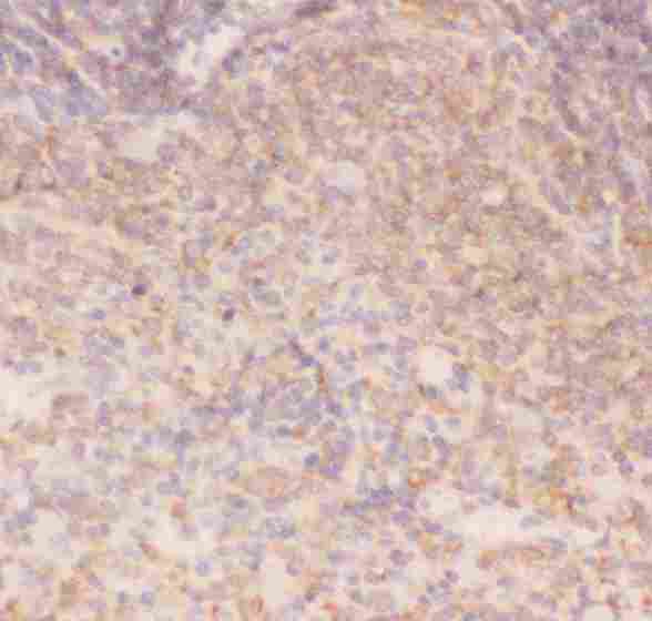 CHUK / IKKA / IKK Alpha Antibody - Anti-IKK alpha Picoband antibody, IHC(P): Rat Spleen Tissue