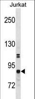 CHUK / IKKA / IKK Alpha Antibody - CHUK Antibody western blot of Jurkat cell line lysates (35 ug/lane). The CHUK antibody detected the CHUK protein (arrow).