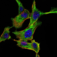 CHUK / IKKA / IKK Alpha Antibody - Immunofluorescence of NIH/3T3 cells using CHUK mouse monoclonal antibody (green). Blue: DRAQ5 fluorescent DNA dye. Red: Actin filaments have been labeled with Alexa Fluor-555 phalloidin.