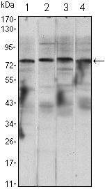 CHUK / IKKA / IKK Alpha Antibody - IKK alpha Antibody in Western Blot (WB)