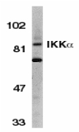 CHUK / IKKA / IKK Alpha Antibody - Western blot of IKKa in Jurkat whole cell lysate with IKKa antibody at 1:500 dilution.
