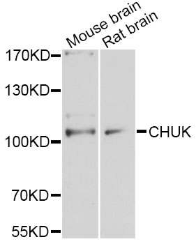 CHUK / IKKA / IKK Alpha Antibody - Western blot analysis of extracts of various cell lines, using CHUK Antibody at 1:1000 dilution. The secondary antibody used was an HRP Goat Anti-Rabbit IgG (H+L) at 1:10000 dilution. Lysates were loaded 25ug per lane and 3% nonfat dry milk in TBST was used for blocking. An ECL Kit was used for detection and the exposure time was 90s.