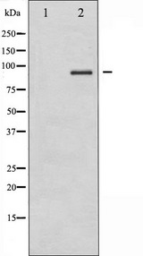 CHUK / IKKA / IKK Alpha Antibody - Western blot analysis of IKK-alpha/beta expression in HepG2 whole cells lysates. The lane on the left is treated with the antigen-specific peptide.