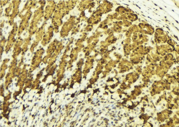 CHUK / IKKA / IKK Alpha Antibody - 1:100 staining human gastric tissue by IHC-P. The sample was formaldehyde fixed and a heat mediated antigen retrieval step in citrate buffer was performed. The sample was then blocked and incubated with the antibody for 1.5 hours at 22°C. An HRP conjugated goat anti-rabbit antibody was used as the secondary.