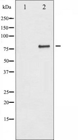 CHUK / IKKA / IKK Alpha Antibody - Western blot analysis of IKK-alpha expression in EGF treated 293 whole cells lysates. The lane on the left is treated with the antigen-specific peptide.