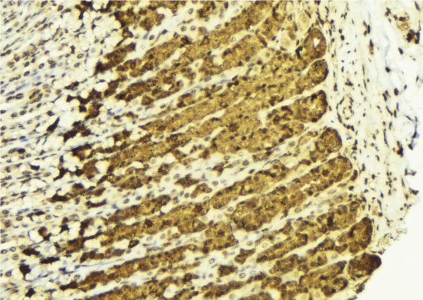 CHUK / IKKA / IKK Alpha Antibody - 1:100 staining human gastric tissue by IHC-P. The sample was formaldehyde fixed and a heat mediated antigen retrieval step in citrate buffer was performed. The sample was then blocked and incubated with the antibody for 1.5 hours at 22°C. An HRP conjugated goat anti-rabbit antibody was used as the secondary.