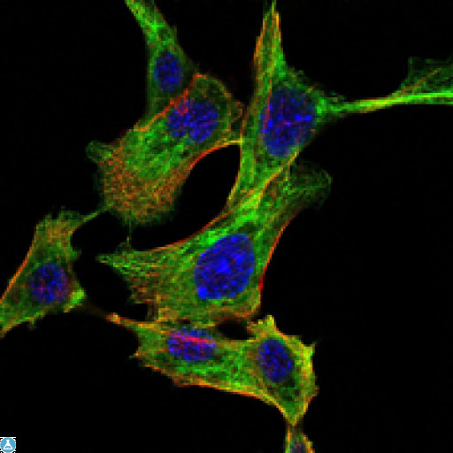 CHUK / IKKA / IKK Alpha Antibody - Immunofluorescence (IF) analysis of NIH/3T3 cells using IKKalpha Monoclonal Antibody (green). Blue: DRAQ5 fluorescent DNA dye. Red: Actin filaments have been labeled with Alexa Fluor-555 phalloidin.
