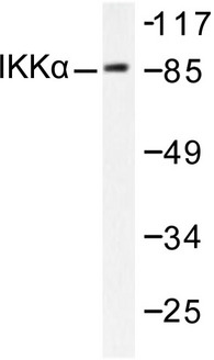 CHUK / IKKA / IKK Alpha Antibody - Western blot of IKK- (M17) pAb in extracts from MDA-MB-435 cells treated with EGF.