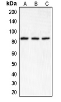 CHUK / IKKA / IKK Alpha Antibody - Western blot analysis of IKK alpha expression in HeLa (A); Raw264.7 (B); PC12 (C) whole cell lysates.