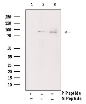 CHUK / IKKA / IKK Alpha Antibody - Western blot analysis of IKK-alpha/IKK beta phosphorylation expression in TNF treated HeLa whole cells lysates. The lane on the right is treated with the antigen-specific peptide.