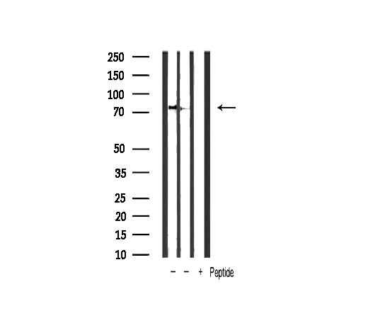 CHUK / IKKA / IKK Alpha Antibody - Western blot analysis of TIMP4 expression in NIH-3T3 whole cells lysates. The lane on the left is treated with the antigen-specific peptide.Western blot analysis of extracts of various cellslines using Phospho-PDK1 (Ser241) antibody.