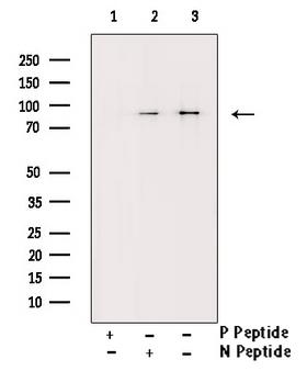CHUK / IKKA / IKK Alpha Antibody - Western blot analysis of Phospho-IKK alpha/beta (Ser180/181) antibody expression in TNF treated HepG2 cells lysates. The lane on the right is treated with the antigen-specific peptide.