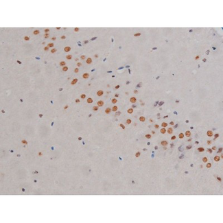 CHUK / IKKA / IKK Alpha Antibody - 1:200 staining mouse brain tissue by IHC-P. The tissue was formaldehyde fixed and a heat mediated antigen retrieval step in citrate buffer was performed. The tissue was then blocked and incubated with the antibody for 1.5 hours at 22°C. An HRP conjugated goat anti-rabbit antibody was used as the secondary.
