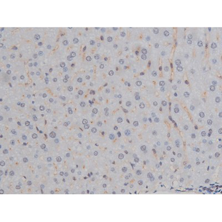 CHUK / IKKA / IKK Alpha Antibody - 1:200 staining mouse liver tissue by IHC-P. The tissue was formaldehyde fixed and a heat mediated antigen retrieval step in citrate buffer was performed. The tissue was then blocked and incubated with the antibody for 1.5 hours at 22°C. An HRP conjugated goat anti-rabbit antibody was used as the secondary.