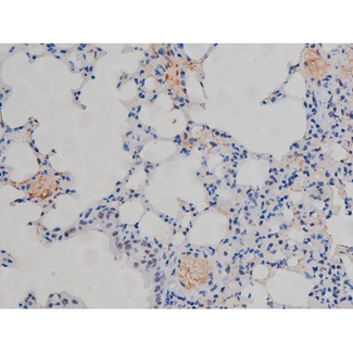 CHUK / IKKA / IKK Alpha Antibody - 1:200 staining mouse lung tissue by IHC-P. The tissue was formaldehyde fixed and a heat mediated antigen retrieval step in citrate buffer was performed. The tissue was then blocked and incubated with the antibody for 1.5 hours at 22°C. An HRP conjugated goat anti-rabbit antibody was used as the secondary.