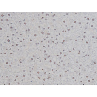 CHUK / IKKA / IKK Alpha Antibody - 1:200 staining rat liver tissue by IHC-P. The tissue was formaldehyde fixed and a heat mediated antigen retrieval step in citrate buffer was performed. The tissue was then blocked and incubated with the antibody for 1.5 hours at 22°C. An HRP conjugated goat anti-rabbit antibody was used as the secondary.