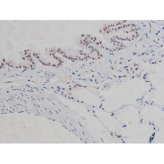 CHUK / IKKA / IKK Alpha Antibody - 1:200 staining rat lung tissue by IHC-P. The tissue was formaldehyde fixed and a heat mediated antigen retrieval step in citrate buffer was performed. The tissue was then blocked and incubated with the antibody for 1.5 hours at 22°C. An HRP conjugated goat anti-rabbit antibody was used as the secondary.