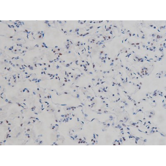 CHUK / IKKA / IKK Alpha Antibody - 1:200 staining rat lung tissue by IHC-P. The tissue was formaldehyde fixed and a heat mediated antigen retrieval step in citrate buffer was performed. The tissue was then blocked and incubated with the antibody for 1.5 hours at 22°C. An HRP conjugated goat anti-rabbit antibody was used as the secondary.