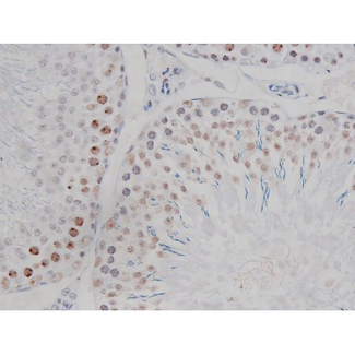 CHUK / IKKA / IKK Alpha Antibody - 1:200 staining rat testis tissue by IHC-P. The tissue was formaldehyde fixed and a heat mediated antigen retrieval step in citrate buffer was performed. The tissue was then blocked and incubated with the antibody for 1.5 hours at 22°C. An HRP conjugated goat anti-rabbit antibody was used as the secondary.