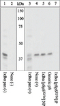 CHUK / IKKA / IKK Alpha Antibody - Extracts of ALLN-pretreated Jurkat cells unstimulated (1, 2) or stimulated with TNF-alpha (3-7) were resolved by SDS-PAGE on a 10% Tris-glycine gel and transferred to PVDF. The membrane was blocked with a 5% BSA-TBST buffer for one hour at room temperature.