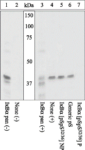 CHUK / IKKA / IKK Alpha Antibody - Extracts of ALLN-pretreated Jurkat cells unstimulated (1, 2) or stimulated with TNF-alpha (3-7) were resolved by SDS-PAGE on a 10% Tris-glycine gel and transferred to PVDF. The membrane was blocked with a 5% BSA-TBST buffer for one hour at room temperature.