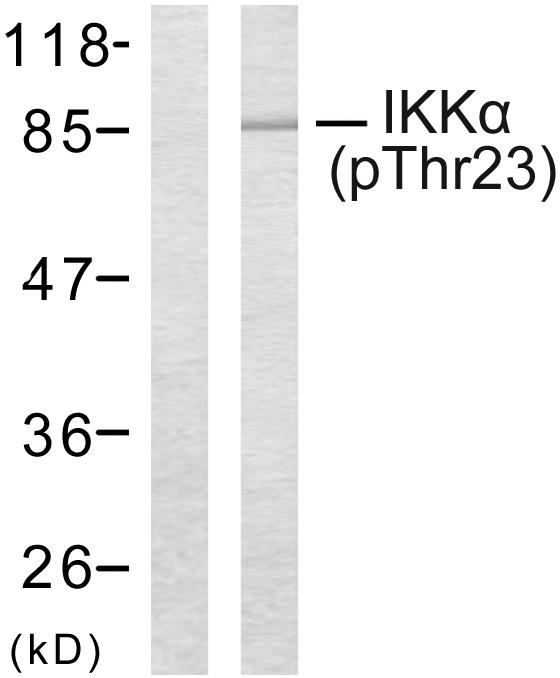 CHUK / IKKA / IKK Alpha Antibody - Western blot analysis of lysates from MDA-MB-435 cells treated with EGF, using IKK-alpha (Phospho-Thr23) Antibody. The lane on the left is blocked with the phospho peptide.