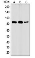 CHUK / IKKA / IKK Alpha Antibody - Western blot analysis of IKK alpha (pT23) expression in HeLa TNFa-treated (A); Raw264.7 TNFa-treated (B); PC12 LPS-treated (C) whole cell lysates.