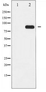 CHUK / IKKA / IKK Alpha Antibody - Western blot of IKK- alpha phosphorylation expression in EGF treated MDA-MB-435 whole cell lysates,The lane on the left is treated with the antigen-specific peptide.