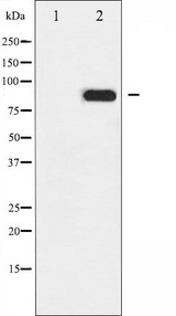 CHUK / IKKA / IKK Alpha Antibody - Western blot analysis of IKK-alpha phosphorylation expression in EGF treated MDA-MB-435 whole cells lysates. The lane on the left is treated with the antigen-specific peptide.