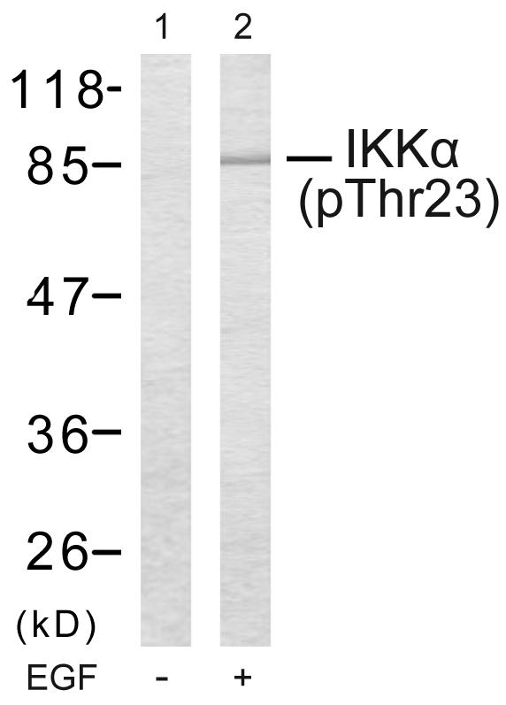 CHUK / IKKA / IKK Alpha Antibody - Western blot analysis of extracts using IKKa (Phospho-Thr23) Antibody. Line1: The extracts from MDA-MB-435 cells untreated; Line2: The extracts from MDA-MB-435 cells treated with EGF.