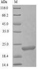 L-rhamnose-binding lectin CSL3 Protein - (Tris-Glycine gel) Discontinuous SDS-PAGE (reduced) with 5% enrichment gel and 15% separation gel.